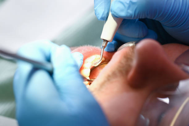 Best Pediatric Emergency Dentist in Harrisville, PA