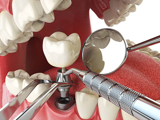 Best Emergency Dental Services for Seniors in Harrisville, PA
